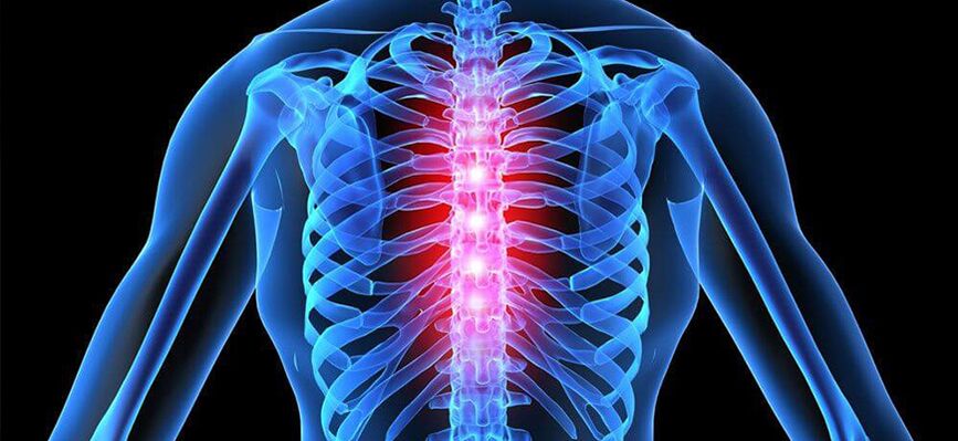 A mellkasi gerinc osteochondrosisának súlyosbodása