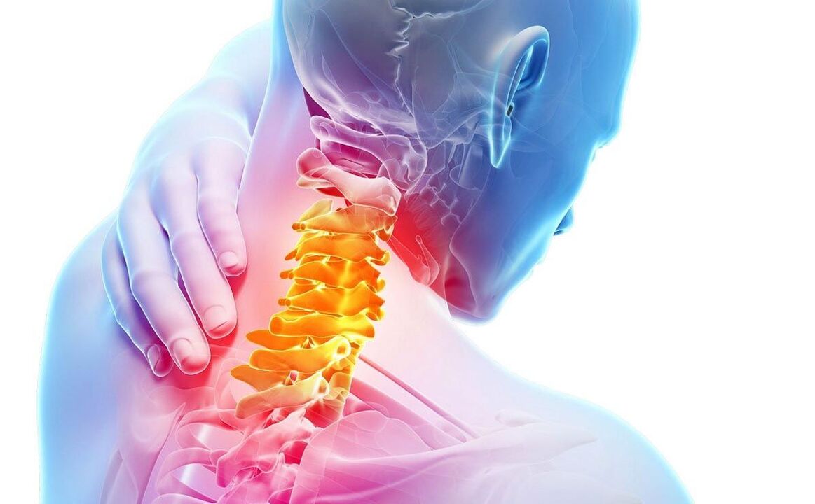 fájdalom nyaki osteochondrosissal