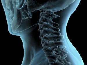 módszerek a nyak osteochondrosisának diagnosztizálására