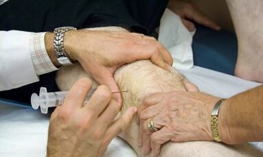 Hogyan lehet megkülönböztetni az ízületi gyulladást az arthrosis -tól